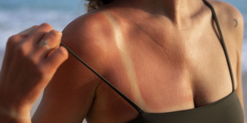 Bacteriile bune ale pielii Nouă frontieră în protecția solară