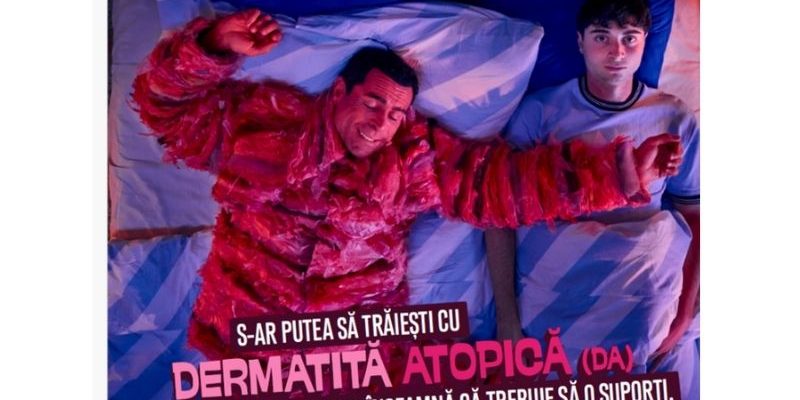 dermatită atopică, Spune DA, sănătate, București, campanie medicală, tratament, pacienți, Societatea Română de Dermatologie, educație medicală, România