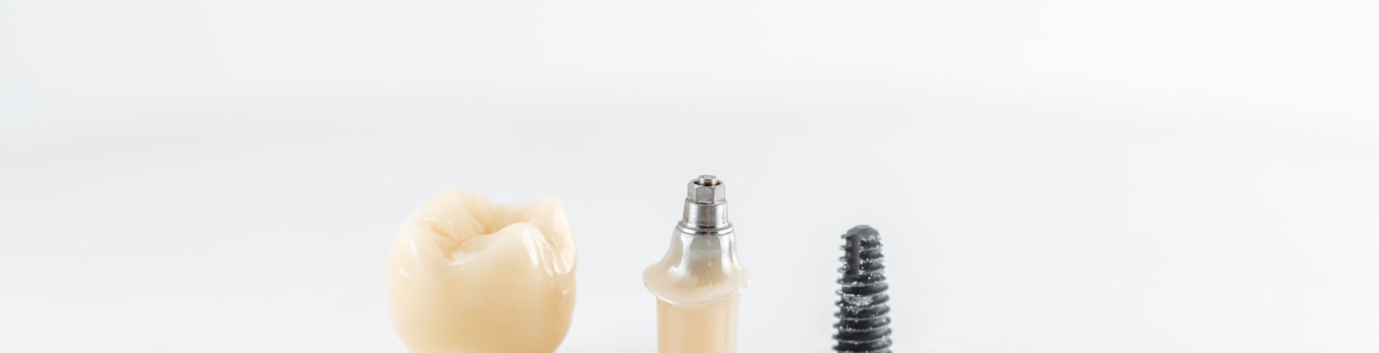 implant dentar România