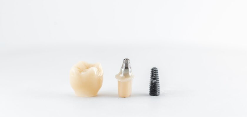 implant dentar România